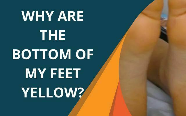 why-are-the-bottom-of-my-feet-yellow-causes-diet-and-tip-zero-tough